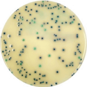 Imagen: Oxoid Brilliance ESBL es una placa de detección cromogénica para la detección de organismos ESBL en 24 horas (Fotografía cortesía de Oxoid).